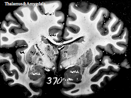 Thalamus & Amygdala