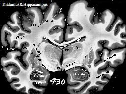 Thalamus & Hippocampus